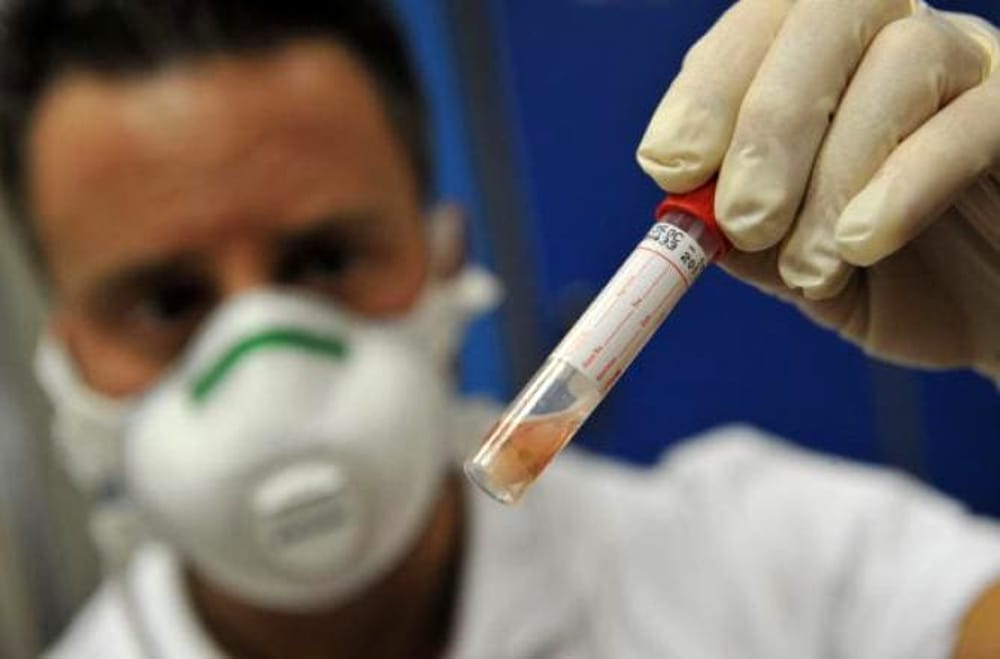 Meningite in Brianza: lo studente di 13 anni non ce l’ha fatta