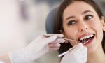 Dentista in Brianza, il dottor Arosio e l’implantologia dentale