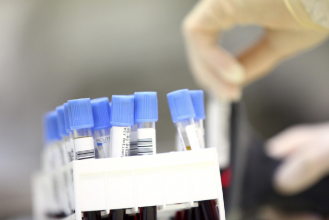 Allarme polmonite, decine di ricoveri