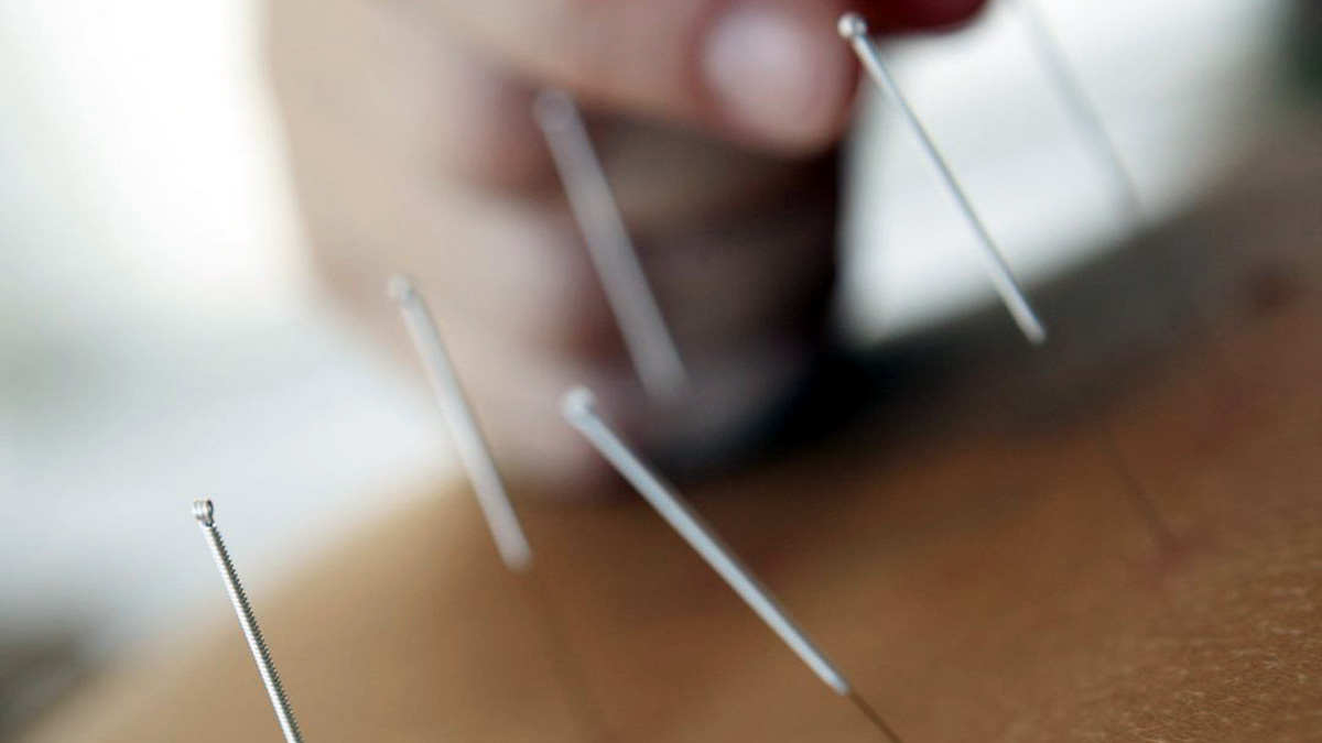 Quando l’agopuntura è abusiva: scoperto falso medico