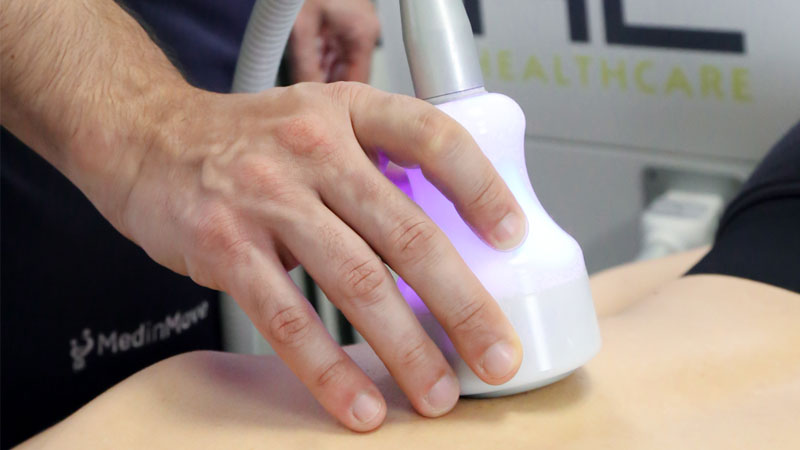 Cryothermolipolisi, ecco il segreto per eliminare grasso, cellulite e rughe