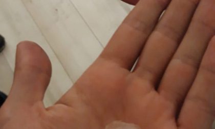 La grandine distrugge i lucernari durante l'assemblea pubblica FOTO e VIDEO