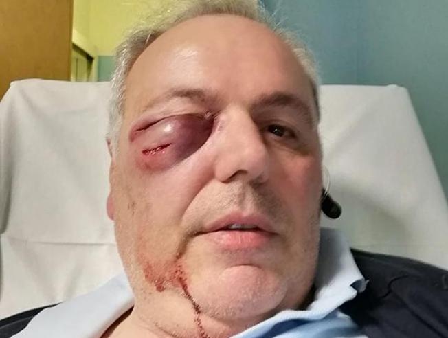 Autista aggredito da uno straniero ubriaco