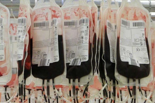 Trasfusione di sangue sbagliata, anziana muore in ospedale in Brianza