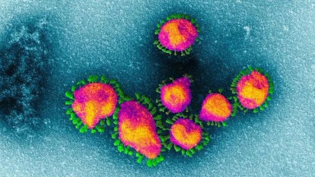 Coronavirus, rientra l’allarme a Merate: escluso il contagio del bimbo