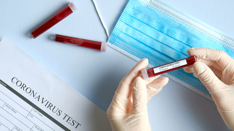Coronavirus: ancora 21 nuovi contagiati nel Lecchese.”Mobilità resta troppo alta” I DATI AGGIORNATI