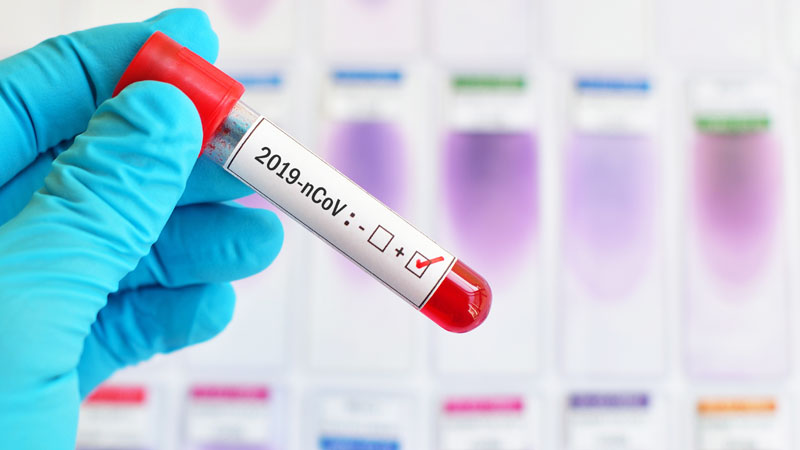 Dal 21 aprile test sierologici a tappeto per medici e in zone più colpite
