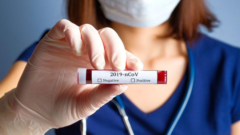 Coronavirus in Lombardia, per ritirare i farmaci basta un codice