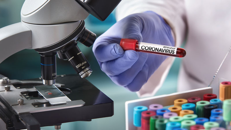 Rapporto tra contagiati da Coronavirus  e residenti nei Comuni lecchesi  I DATI