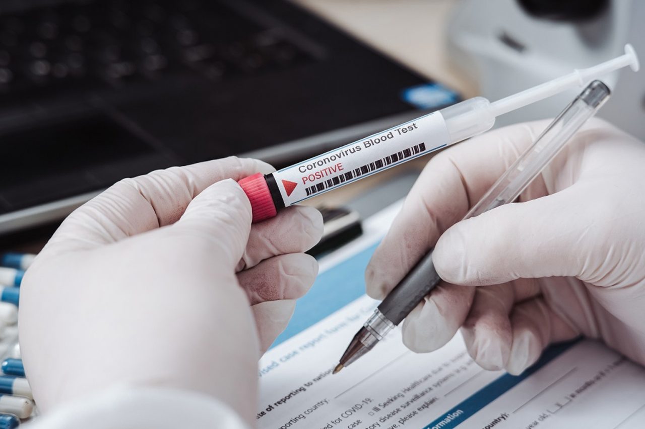 Su 1.286 test sierologici eseguiti da Ats Brianza il 33,3% è positivo. Tra i sanitari il 7,5%