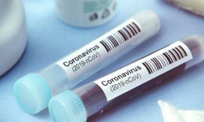 Coronavirus: ancora  428 nuovi casi a Lecco