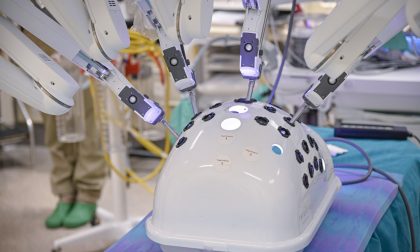 Chirurgia all'avanguardia all'ospedale di Lecco con il robot Da Vinci Xi FOTO