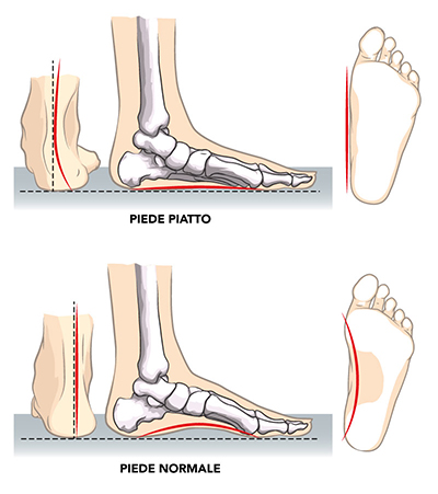 PIEDE_PIATTO_normale