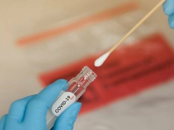 Tamponi molecolari: tutti i costi e le disponibilità a Lecco