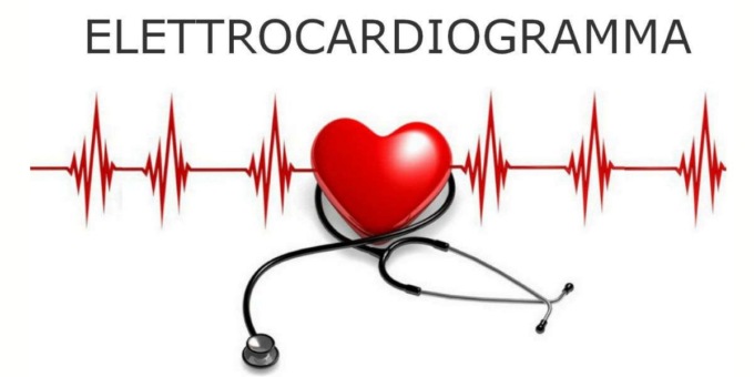 Controllo gratuito al cuore per i donatori di Avis Valmadrera