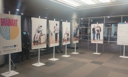 Brainart: mostra nella hall dell'Ospedale Manzoni