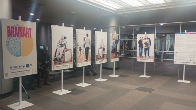 Brainart: mostra nella hall dell’Ospedale Manzoni