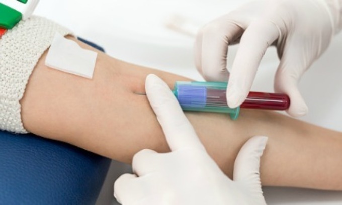 Caos ai centri prelievi per il nuovo sistema operativo