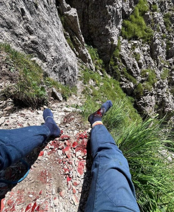 Grignetta: masso si stacca dal Torrione Palma, la testimonianza degli scalatori feriti