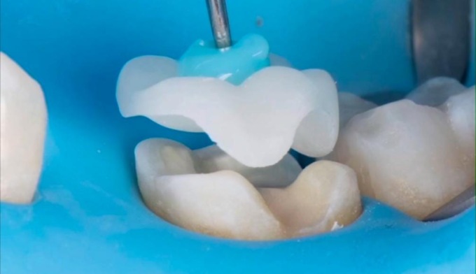 Il dentista spiega: l’odontoiatria conservativa