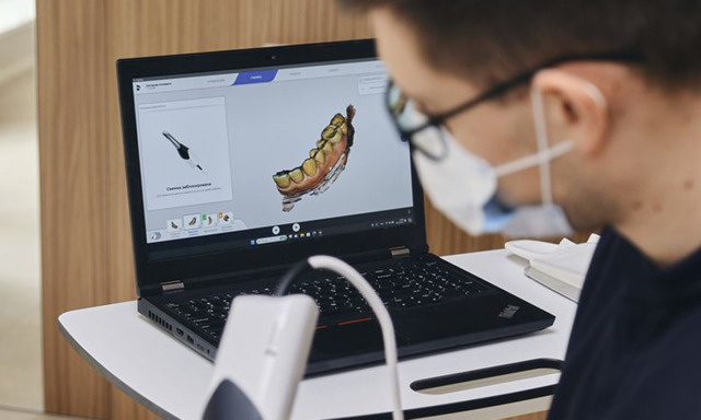 Che cos’è l’impronta digitale e quali i principali vantaggi