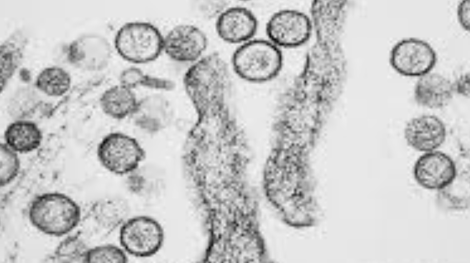 Hantavirus, negativi i test sul turista britannico ricoverato in Lombardia