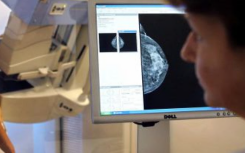 Liste d’attesa Asst Lecco: ortopedia promossa ma mammografie fino a 468 giorni