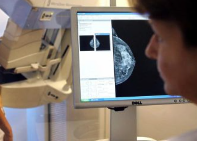 Liste d’attesa Asst Lecco: ortopedia promossa ma mammografie fino a 468 giorni